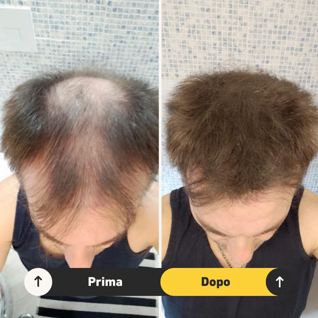 2 Fibre copri Calvizie da 27.5gr | Castano Medio - HairFiberPlus