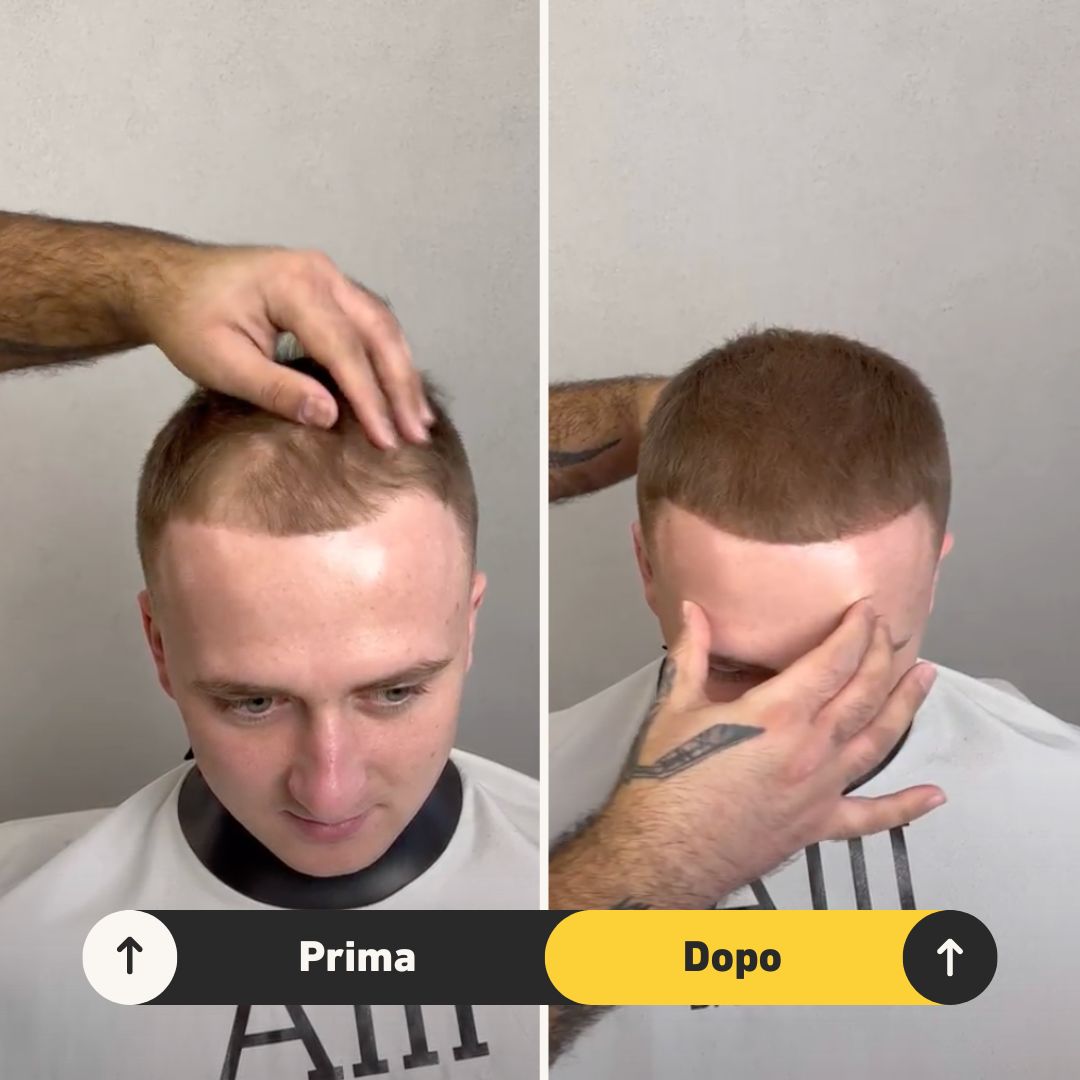 2 Fibre copri Calvizie da 27.5gr | Castano Chiaro - HairFiberPlus