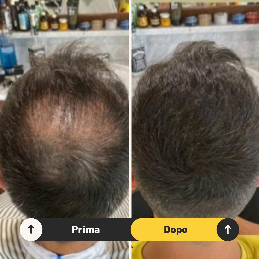 2 Fibre copri Calvizie da 27.5gr | Castano Scuro - HairFiberPlus