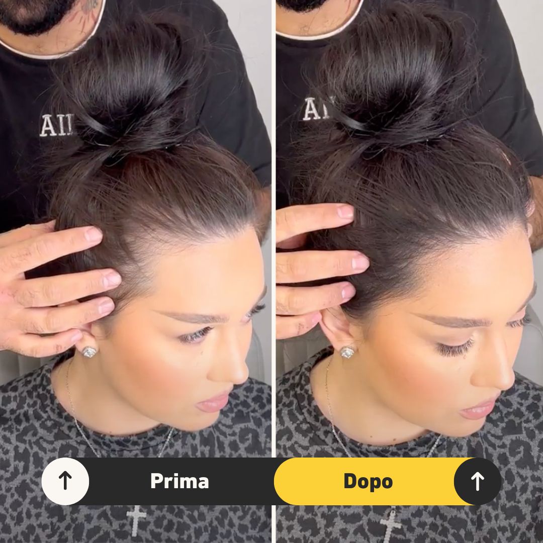 Fibre copri Calvizie da 7gr  | Castano Scuro | 15 Giorni Applicazione - HairFiberPlus