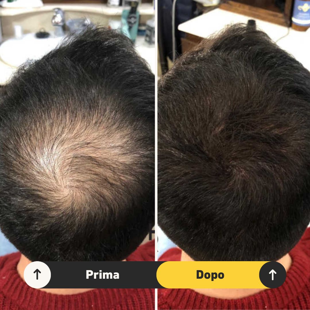 Fibre copri Calvizie da 7gr | Nero | 15 Giorni Applicazione - HairFiberPlus