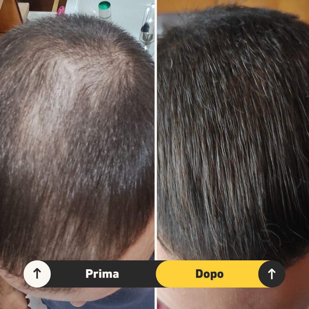 6 Fibre copri Calvizie da 27.5gr | Nero - HairFiberPlus