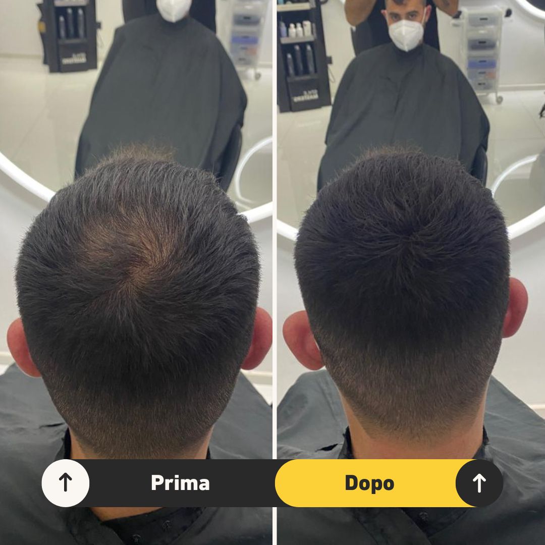 Fibre copri Calvizie da 7gr | Nero | 15 Giorni Applicazione - HairFiberPlus