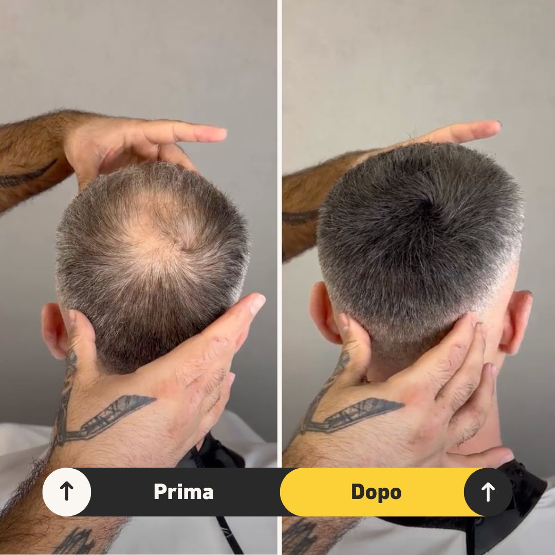 Fibre copri Calvizie da 7gr | Nero | 15 Giorni Applicazione - HairFiberPlus