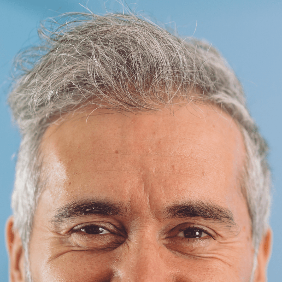 Fibre copri Calvizie da 7gr | Grigio | 15 Giorni Applicazione - HairFiberPlus