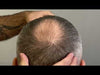 Load and play video in Gallery viewer, Baldness cover fibers 27.5gr | 60 Days of Applications